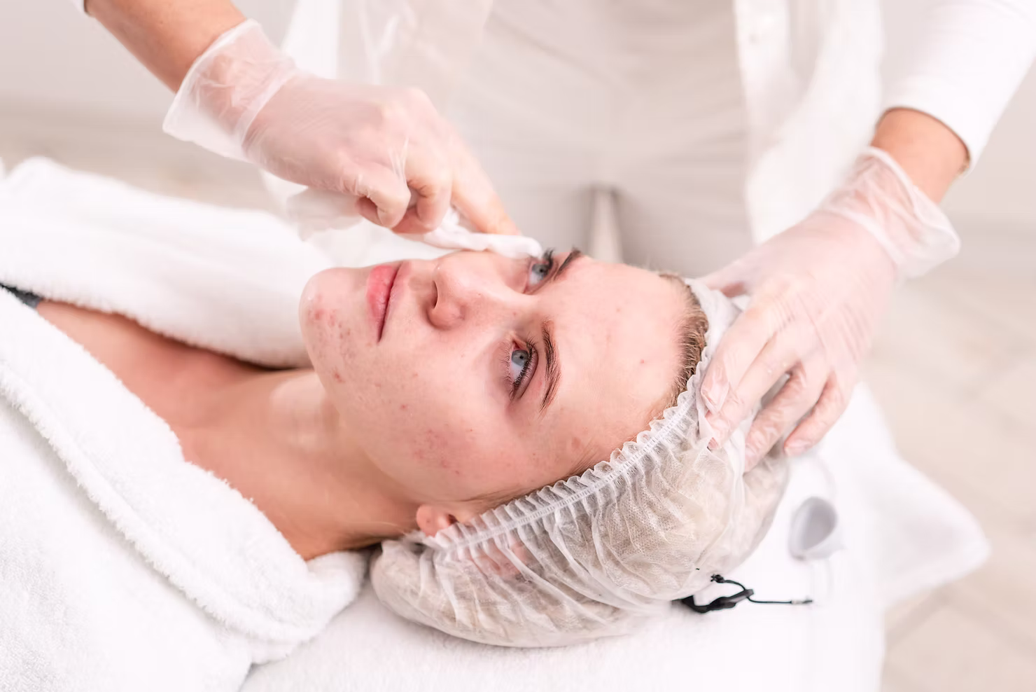 Building Healthy Skin in Canberra: A Layered Approach to Pigmentation, Acne, and Firmness